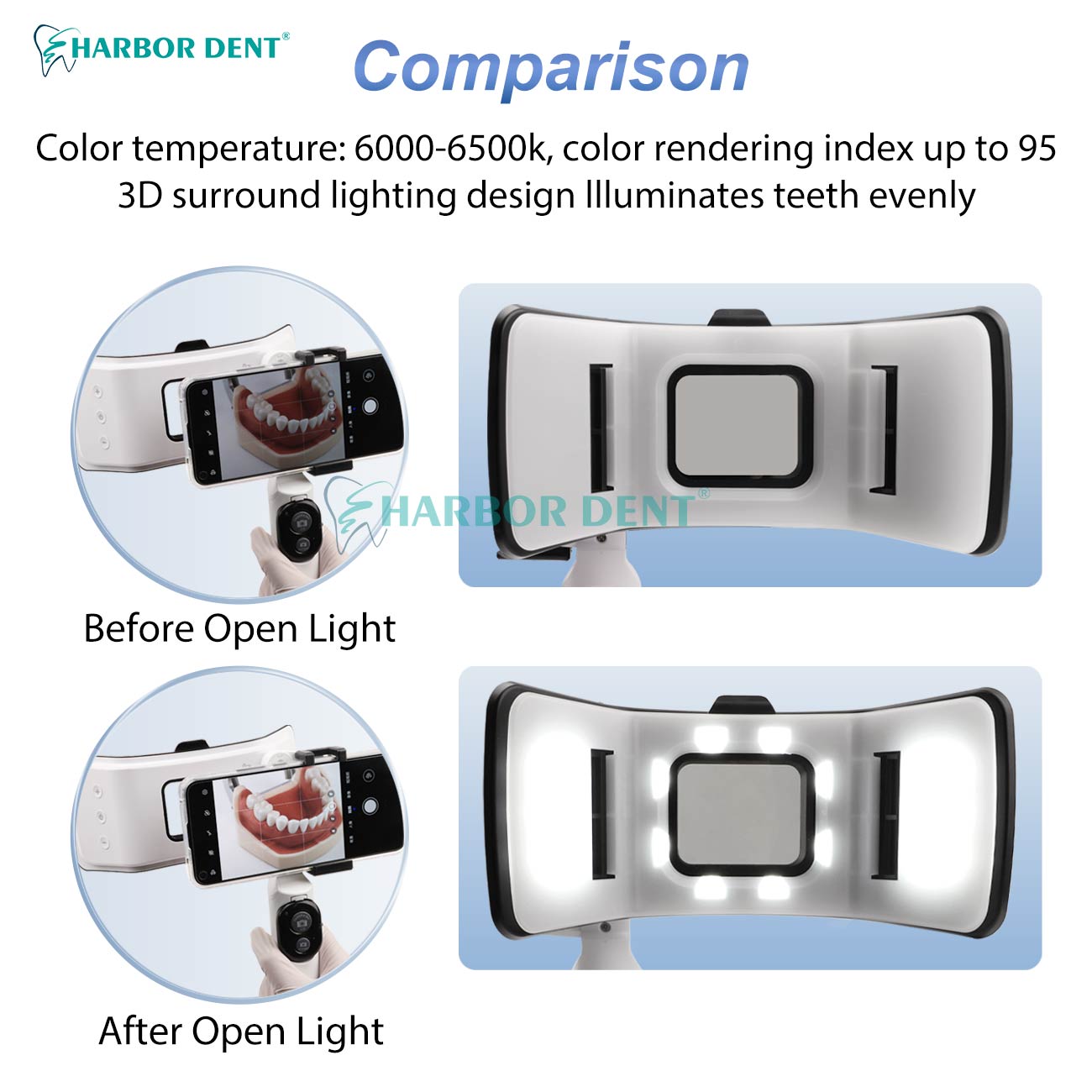 Good Price Dental Photography  - Good Lighting In Photography ulasan dan harga