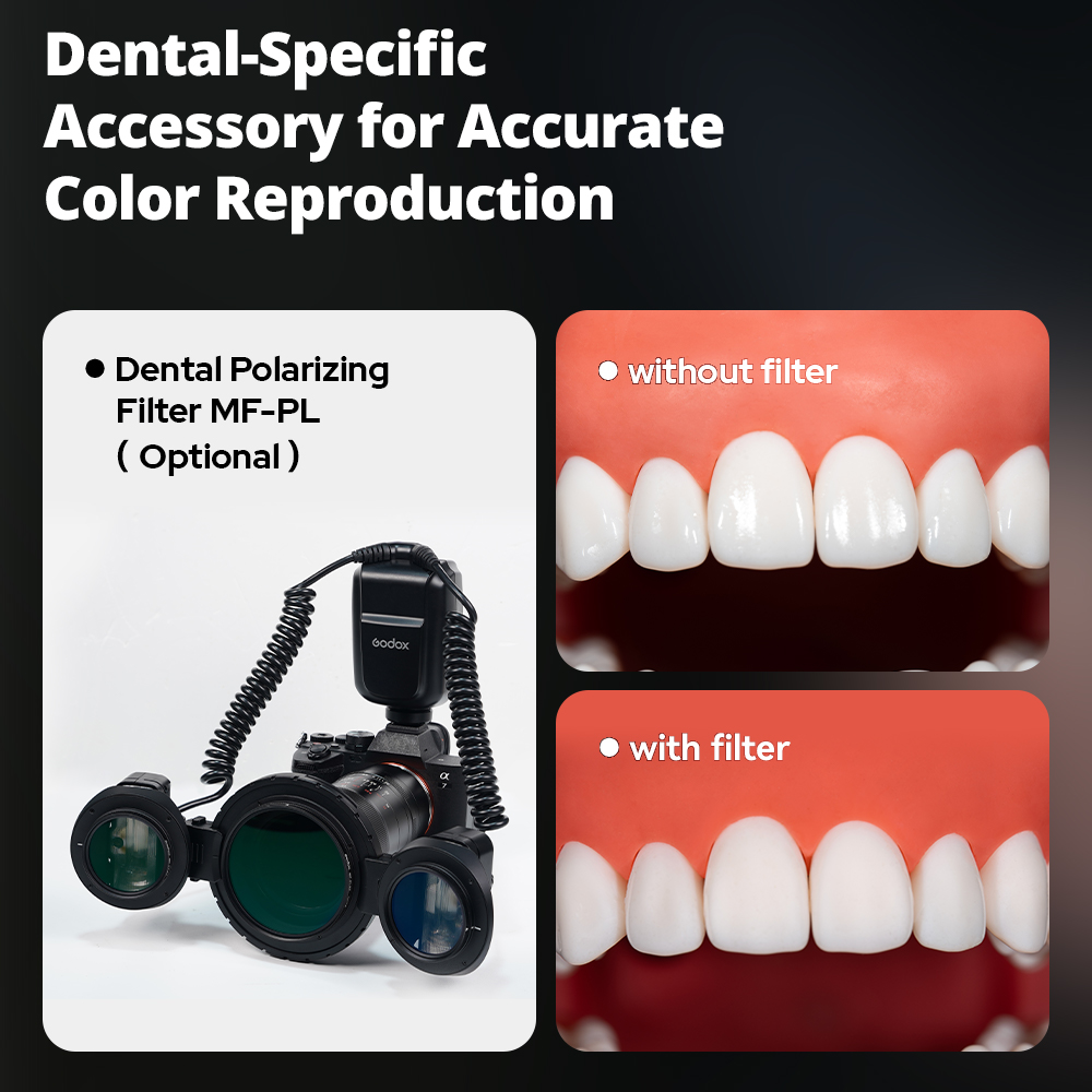 GODOX MF-T76 Dentist Macro Twi - Photography Lighting Godox ulasan dan harga