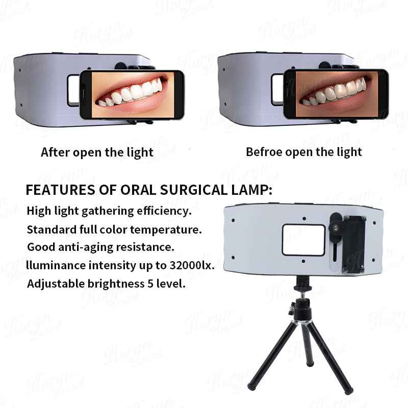 Dental Flash Light Photography - Photography Lighting Flash ulasan dan harga